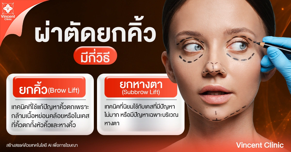 ผ่าตัดยกคิ้วมีกี่วิธี