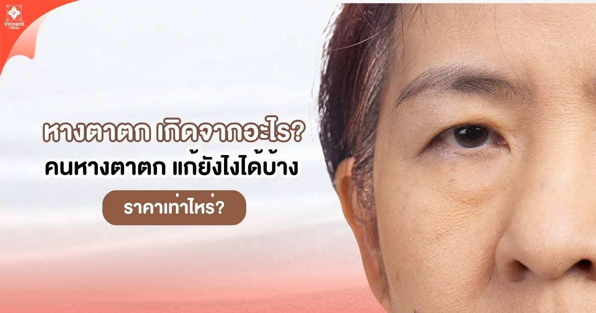 หางตาตก เกิดจากอะไร