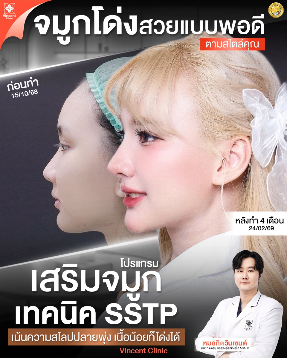 เสริมจมูก SSTP  vincent