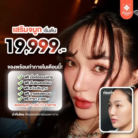 โปรเสริมจมูก